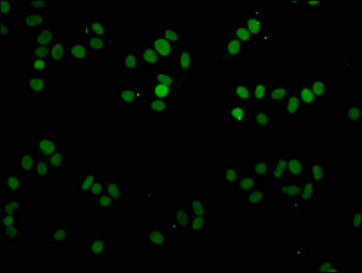 Immunofluorescence staining of HepG2 cells with CSB-PA010087OA81me1HU at 1:2.5, counter-stained with DAPI. The cells were fixed in 4% formaldehyde, permeabilized using 0.2% Triton X-100 and blocked in 10% normal Goat Serum. The cells were then inc...