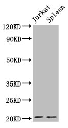 Western Blot Positive WB detected in: Jurkat whole cell lysate, Rat spleen tissue All lanes: H1F0 antibody at 1.5µg/ml Secondary Goat polyclonal to rabbit IgG at 1/50000 dilution Predicted band size: 21, 20 kDa Observed band size: 21 kDa