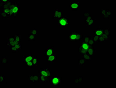Immunofluorescent analysis of HepG2 cells using CSB-PA010087PA11me1HU at dilution of 1:100 and Alexa Fluor 488-congugated AffiniPure Goat Anti-Rabbit IgG(H+L)