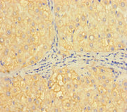 Immunohistochemistry of paraffin-embedded human liver tissue using CSB-PA010091LA01HU at dilution of 1:100