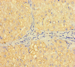 Immunohistochemistry of paraffin-embedded human liver tissue using CSB-PA010091LA01HU at dilution of 1:100