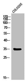 Western Blot analysis of COLO205 cells using MC1-R Polyclonal Antibody