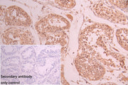 IHC image of CSB-PA010094DA01HU diluted at 1:50 and staining in paraffin-embedded human testis tissue performed on a Leica BondTM system. After dewaxing and hydration, antigen retrieval was mediated by high pressure in a citrate buffer (pH 6.0). S...