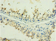 Immunohistochemistry of paraffin-embedded human testis tissue using CSB-PA010097DSR1HU at dilution of 1:100