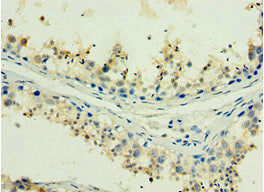 Immunohistochemistry of paraffin-embedded human testis tissue using CSB-PA010097DSR1HU at dilution of 1:100