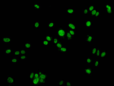 Immunofluorescence staining of HepG2 cells with CSB-PA010097OA142phHU at 1:25, counter-stained with DAPI. The cells were fixed in 4% formaldehyde, permeabilized using 0.2% Triton X-100 and blocked in 10% normal Goat Serum. The cells were then incu...