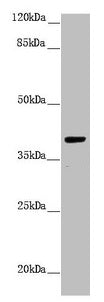 Western blot All lanes: H2AFY antibody at 1.43µg/ml + Hela whole cell lysate Secondary Goat polyclonal to rabbit IgG at 1/10000 dilution Predicted band size: 40 kDa Observed band size: 40 kDa