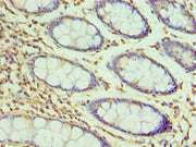 Immunohistochemistry of paraffin-embedded human colon tissue using CSB-PA010100ESR2HU at dilution of 1:100