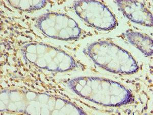 Immunohistochemistry of paraffin-embedded human colon tissue using CSB-PA010100ESR2HU at dilution of 1:100
