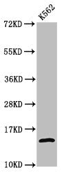Western Blot Positive WB detected in: K562 whole cell lysate (treated by 30mM sodium butyrate for 4h) All lanes: H2AFZ antibody at 1.06µg/ml Secondary Goat polyclonal to rabbit IgG at 1/50000 dilution Predicted band size: 14 kDa Observed band size...