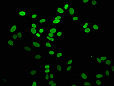 Immunofluorescence staining of Hela cells with CSB-PA010100OA04me1HU at 1:5, counter-stained with DAPI. The cells were fixed in 4% formaldehyde, permeabilized using 0.2% Triton X-100 and blocked in 10% normal Goat Serum. The cells were then incuba...