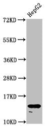 Western Blot Positive WB detected in: HepG2 whole cell lysate All lanes: H2AFZ antibody at 1.96µg/ml Secondary Goat polyclonal to rabbit IgG at 1/50000 dilution Predicted band size: 14 kDa Observed band size: 14 kDa