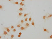 Immunocytochemistry analysis of CSB-PA010100OA07me1HU diluted at 1:20 and staining in Hela cells performed on a Leica BondTM system. The cells were fixed in 4% formaldehyde, permeabilized using 0.2% Triton X-100 and blocked with 10% normal goat se...