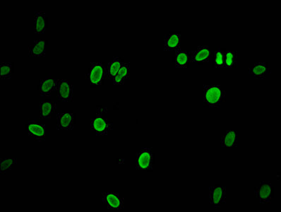Immunofluorescent analysis of Hela cells using CSB-PA010100PA07nme1HU at dilution of 1:100 and Alexa Fluor 488-congugated AffiniPure Goat Anti-Rabbit IgG(H+L)