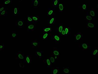 Immunofluorescent analysis of Hela cells (sodium butyrate, 30 mM, 4h) using CSB-PA010100PA11acHU at dilution of 1:100 and Alexa Fluor 488-congugated AffiniPure Goat Anti-Rabbit IgG(H+L)