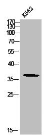 Western blot analysis of K562 using p-Mcl-1 (S159) antibody.