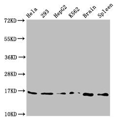 Western Blot Positive WB detected in: Hela whole cell lysate, 293 whole cell lysate, HepG2 whole cell lysate, K562 whole cell lysate, Rat brain tissue, Rat spleen tissue All lanes: H3F3A antibody at 0.73µg/ml Secondary Goat polyclonal to rabbit Ig...