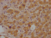 IHC image of CSB-PA010111LA01HU diluted at 1:100 and staining in paraffin-embedded human liver tissue performed on a Leica BondTM system. After dewaxing and hydration, antigen retrieval was mediated by high pressure in a citrate buffer (pH 6.0). S...