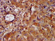 IHC image of CSB-PA010123LA01HU diluted at 1:200 and staining in paraffin-embedded human liver tissue performed on a Leica BondTM system. After dewaxing and hydration, antigen retrieval was mediated by high pressure in a citrate buffer (pH 6.0). S...