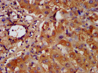 IHC image of CSB-PA010123LA01HU diluted at 1:200 and staining in paraffin-embedded human liver tissue performed on a Leica BondTM system. After dewaxing and hydration, antigen retrieval was mediated by high pressure in a citrate buffer (pH 6.0). S...