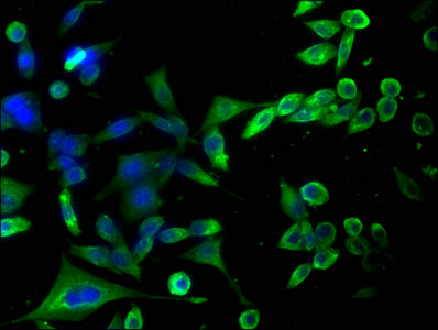 Immunofluorescence staining of SH-SY5Y cells with CSB-PA010129LA01HU at 1:100, counter-stained with DAPI. The cells were fixed in 4% formaldehyde, permeabilized using 0.2% Triton X-100 and blocked in 10% normal Goat Serum. The cells were then incu...