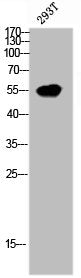 Western Blot analysis of 293T cells using MDMX Polyclonal Antibody