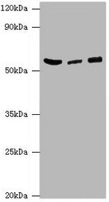 Western blot All lanes: HARS antibody at 6ug/ml Lane 1: Hela whole cell lysate Lane 2: K562 whole cell lysate Lane 3: 293T whole cell lysate Secondary Goat polyclonal to rabbit IgG at 1/10000 dilution Predicted band size: 58, 53, 51, 55 kDa Observ...