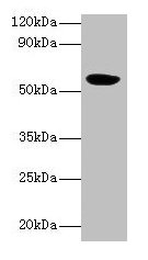 Western blot All lanes: HARS2 antibody at 2µg/ml + Mouse kidney tissue Secondary Goat polyclonal to rabbit IgG at 1/10000 dilution Predicted band size: 57, 55 kDa Observed band size: 57 kDa