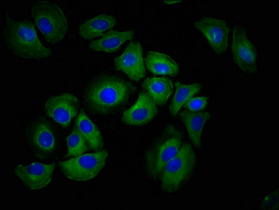 Immunofluorescence staining of A549 cells with CSB-PA010139LA01HU at 1:100, counter-stained with DAPI. The cells were fixed in 4% formaldehyde, permeabilized using 0.2% Triton X-100 and blocked in 10% normal Goat Serum. The cells were then incubat...