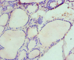 Immunohistochemistry of paraffin-embedded human thyroid tissue using CSB-PA010142ESR1HU at dilution of 1:100