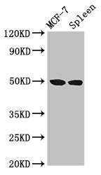 Western Blot Positive WB detected in: MCF-7 whole cell lysate, Rat spleen tissue All lanes: HAT1 antibody at 3µg/ml Secondary Goat polyclonal to rabbit IgG at 1/50000 dilution Predicted band size: 50, 40 kDa Observed band size: 50 kDa