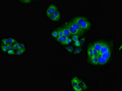 Immunofluorescent analysis of PC-3 cells using CSB-PA010145LA01HU at dilution of 1:100 and Alexa Fluor 488-congugated AffiniPure Goat Anti-Rabbit IgG(H+L)