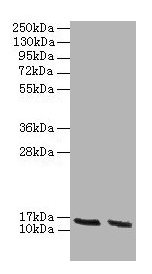 Western blot All lanes: Hba antibody at 2µg/ml Lane 1: HepG2 whole cell lysate Lane 2: Hela whole cell lysate Secondary Goat polyclonal to rabbit IgG at 1/10000 dilution Predicted band size: 16 kDa Observed band size: 16 kDa