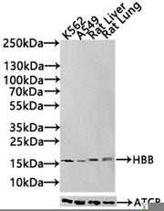 Western Blot Positive WB detected in: Rat liver tissue All lanes: HBB antibody at 3µg/ml Secondary Goat polyclonal to rabbit IgG at 1/50000 dilution Predicted band size: 16 kDa Observed band size: 16 kDa