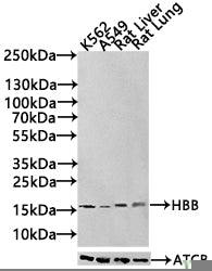 Western Blot Positive WB detected in: Rat liver tissue All lanes: HBB antibody at 3µg/ml Secondary Goat polyclonal to rabbit IgG at 1/50000 dilution Predicted band size: 16 kDa Observed band size: 16 kDa
