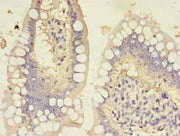 Immunohistochemistry of paraffin-embedded human small intestine tissue using CSB-PA010152LA01HU at dilution of 1:100