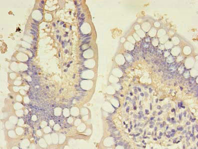 Immunohistochemistry of paraffin-embedded human small intestine tissue using CSB-PA010152LA01HU at dilution of 1:100