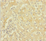 Immunohistochemistry of paraffin-embedded human liver tissue using CSB-PA010155HA01HU at dilution of 1:100