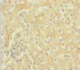 Immunohistochemistry of paraffin-embedded human liver tissue using CSB-PA010155HA01HU at dilution of 1:100