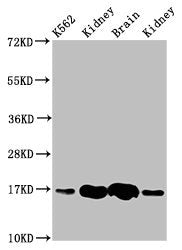 Western Blot Positive WB detected in: K562 whole cell lysate, Rat kideny tissue, Rat brain tissue, Mouse kidney tissue All lanes: HBG2 antibody at 4.6µg/ml Secondary Goat polyclonal to rabbit IgG at 1/50000 dilution Predicted band size: 17 kDa Obs...
