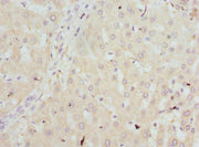 Immunohistochemistry of paraffin-embedded human liver tissue using CSB-PA010162DSR2HU at dilution of 1:100