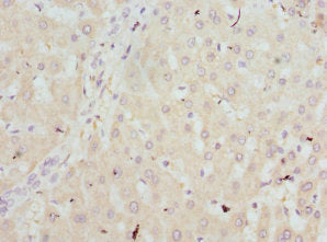 Immunohistochemistry of paraffin-embedded human liver tissue using CSB-PA010162DSR2HU at dilution of 1:100