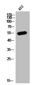 Western Blot analysis of 453 cells using MEF-2 Polyclonal Antibody