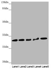 Western blot All lanes: HCCS antibody at 2.05µg/ml Lane 1: Mouse heart tissue Lane 2: Hela whole cell lysate Lane 3: RAW264.7 whole cell lysate Lane 4: MCF-7 whole cell lysate Lane 5: HepG2 whole cell lysate Secondary Goat polyclonal to rabbit IgG...