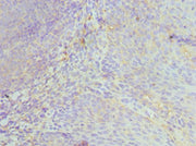 Immunohistochemistry of paraffin-embedded human tonsil tissue using CSB-PA010211ESR1HU at dilution of 1:100