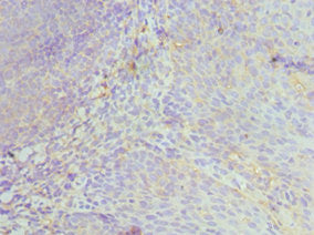 Immunohistochemistry of paraffin-embedded human tonsil tissue using CSB-PA010211ESR1HU at dilution of 1:100