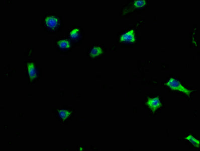 Immunofluorescence staining of SH-SY5Y cells with CSB-PA010231HA01HU at 1:133, counter-stained with DAPI. The cells were fixed in 4% formaldehyde, permeabilized using 0.2% Triton X-100 and blocked in 10% normal Goat Serum. The cells were then incu...