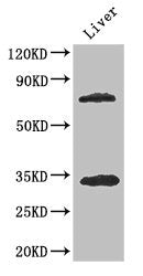 Western Blot Positive WB detected in: Mouse liver tissue All lanes: HDAC10 antibody at 3.4ug/ml Secondary Goat polyclonal to rabbit IgG at 1/50000 dilution Predicted band size: 72, 70, 71, 44 kDa Observed band size: 72, 34 kDa