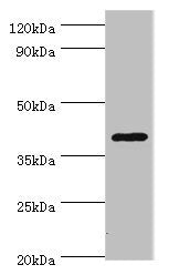 Western blot All lanes: HDAC11 antibody at 2ug/ml + Mouse brain tissue Secondary Goat polyclonal to rabbit IgG at 1/10000 dilution Predicted band size: 40, 34 kDa Observed band size: 40 kDa