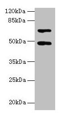Western blot All lanes: HDAC3 antibody at 2µg/ml + Hela whole cell lysate Secondary Goat polyclonal to rabbit IgG at 1/10000 dilution Predicted band size: 49, 50 kDa Observed band size: 49 kDa